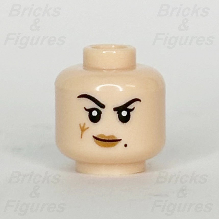 epi