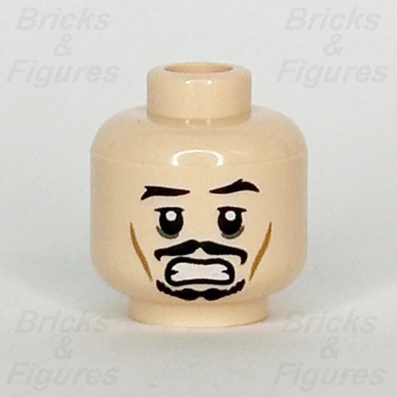 epi