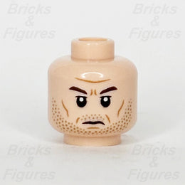 epi