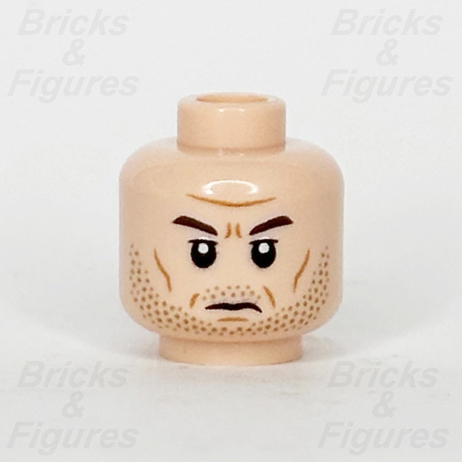 epi
