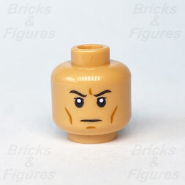 epi