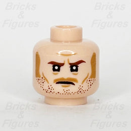 epi