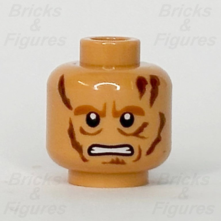 epi