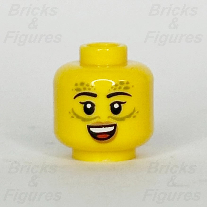 epi