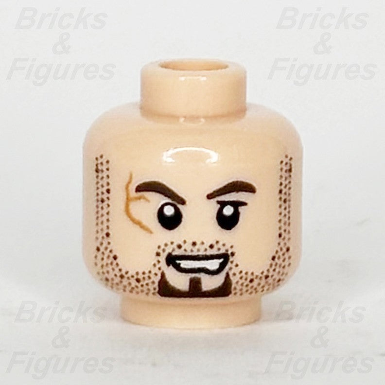 epi