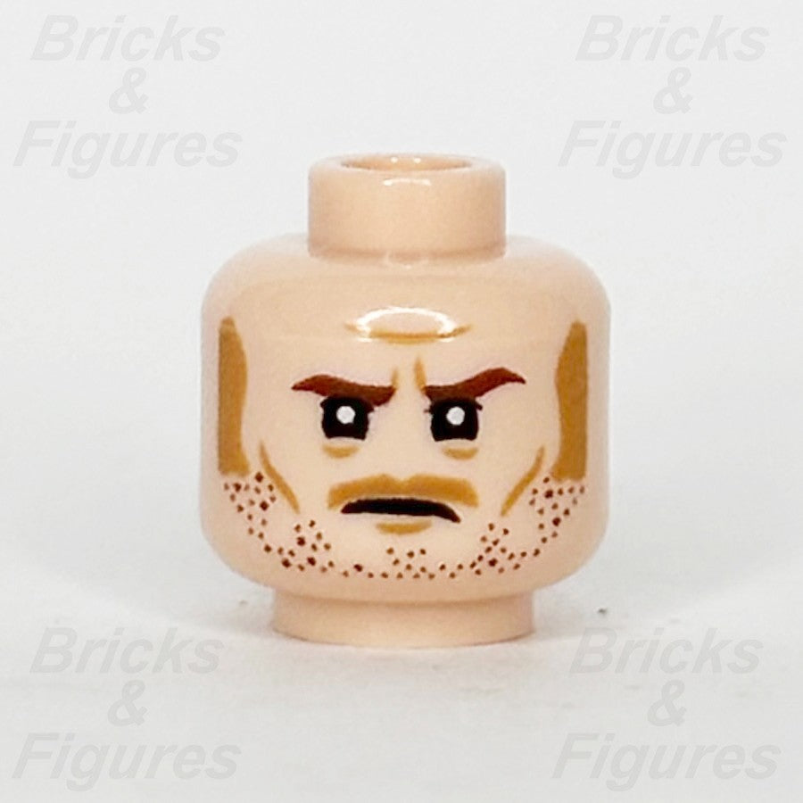 epi